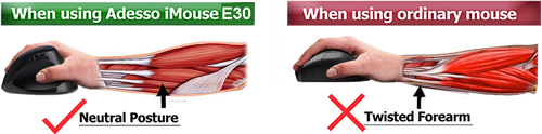 Neutral Posture of Adesso iMouse E30 Wireless Vertical Programmable Mouse