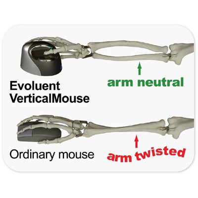 Evoluent VM4S Vertical Mouse 4 Right Small Ergonomic Mouse - Wired