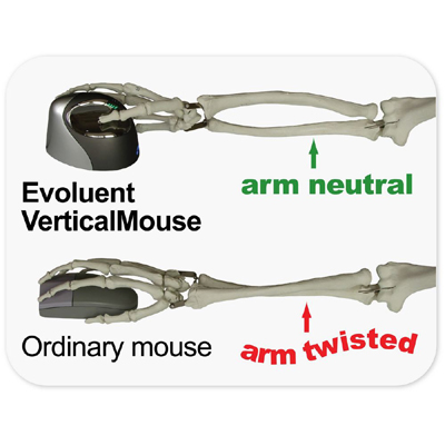 Evoluent VM4L Vertical Mouse 4 Left - Wired