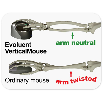 SHC- Evoluent VM4L Vertical Mouse 4 Left - Wired