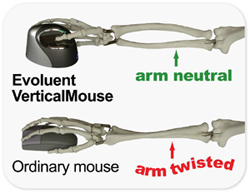 Avoids forearm twisting for comfort and good health