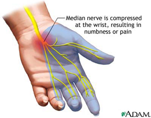 Carpal Tunnel with Median Nerve