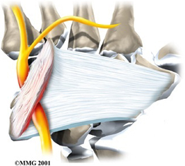 Guyon's Canal with Ulnar Nerve